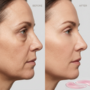 Collagen Eye Patches Hydrogel Anti Dark Circles